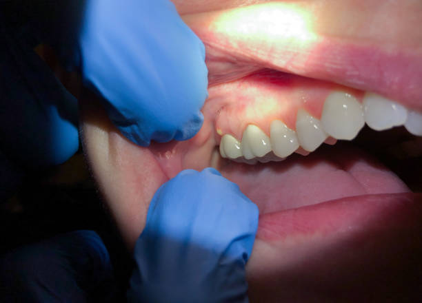 Best Emergency Cosmetic Dentistry (e.g., broken veneers) in South Huntington, NY