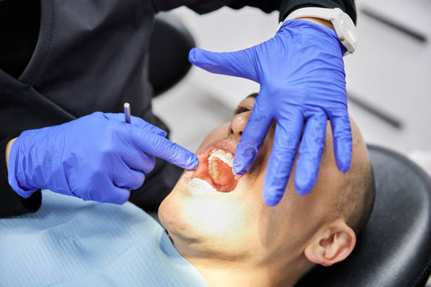 Best Broken or Chipped Tooth Repair in South Huntington, NY